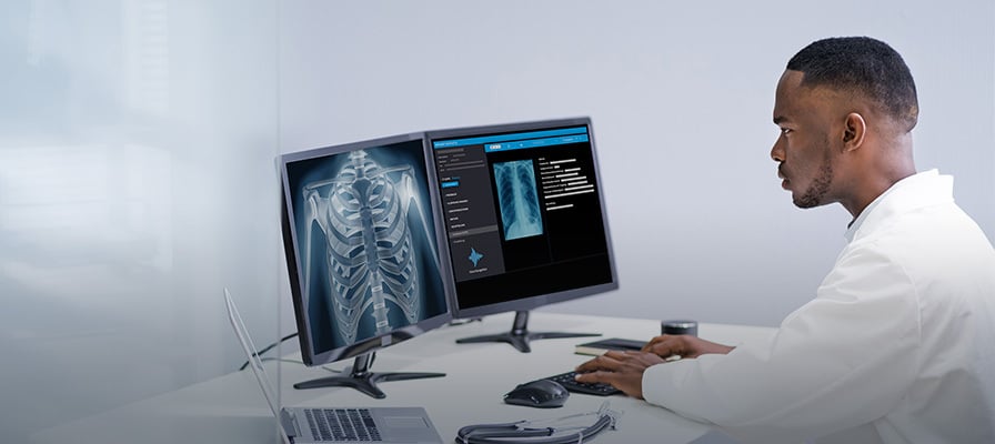 Radiologist working with 2 screens. First shows a chest xray, second shows the creation of a medical report