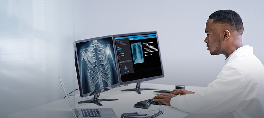 Radiologist working with 2 screens. First shows a chest xray, second shows the creation of a medical report Radiologist working with 2 screens. First shows a chest xray, second shows the creation of a medical report