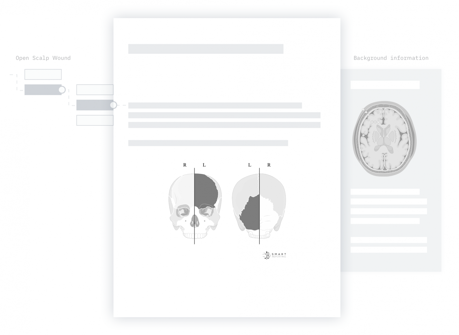 mock up of the creation of a structured report with decision tree and Infobox