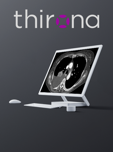 Thirona Logo and Screen with Screenshot of a lung CT scan