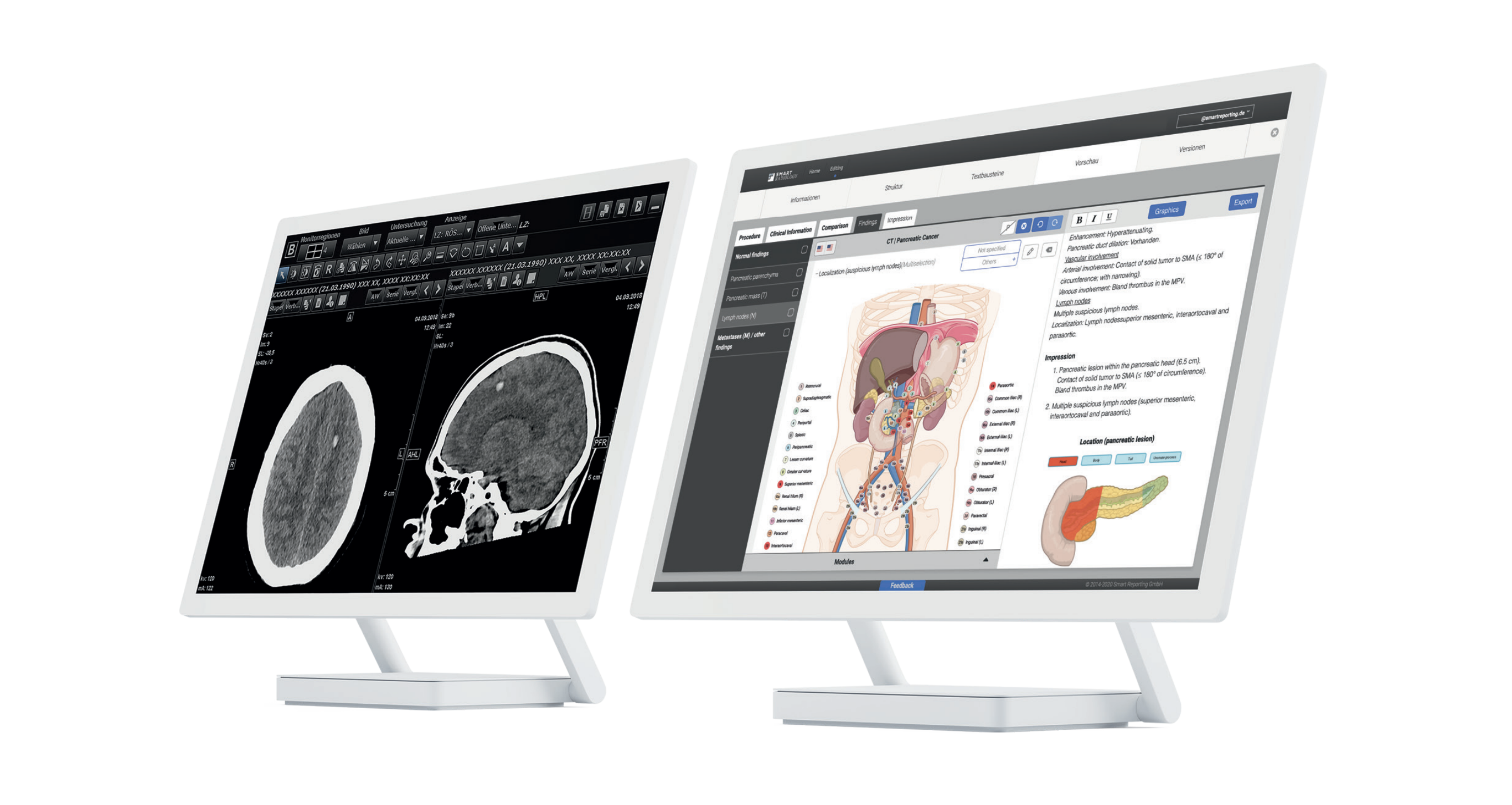 2 Screens. One Screen with MRT Image of the head, other screen with sketch elements of abdomen