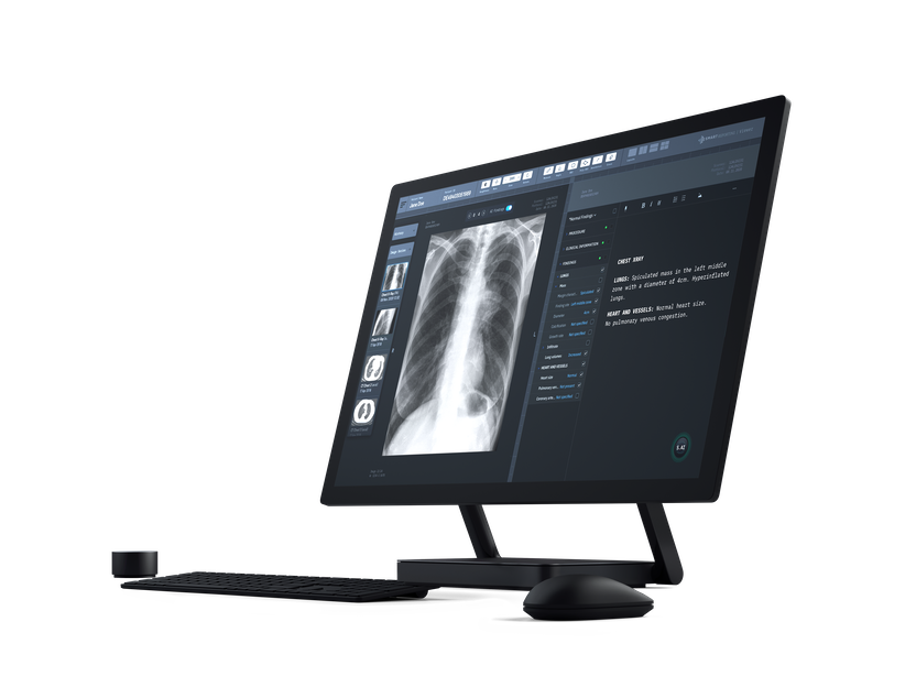 Bildschirm mit Roentgen Thorax und strukturiertem Befund Bildschirm mit Roentgen Thorax und strukturiertem Befund