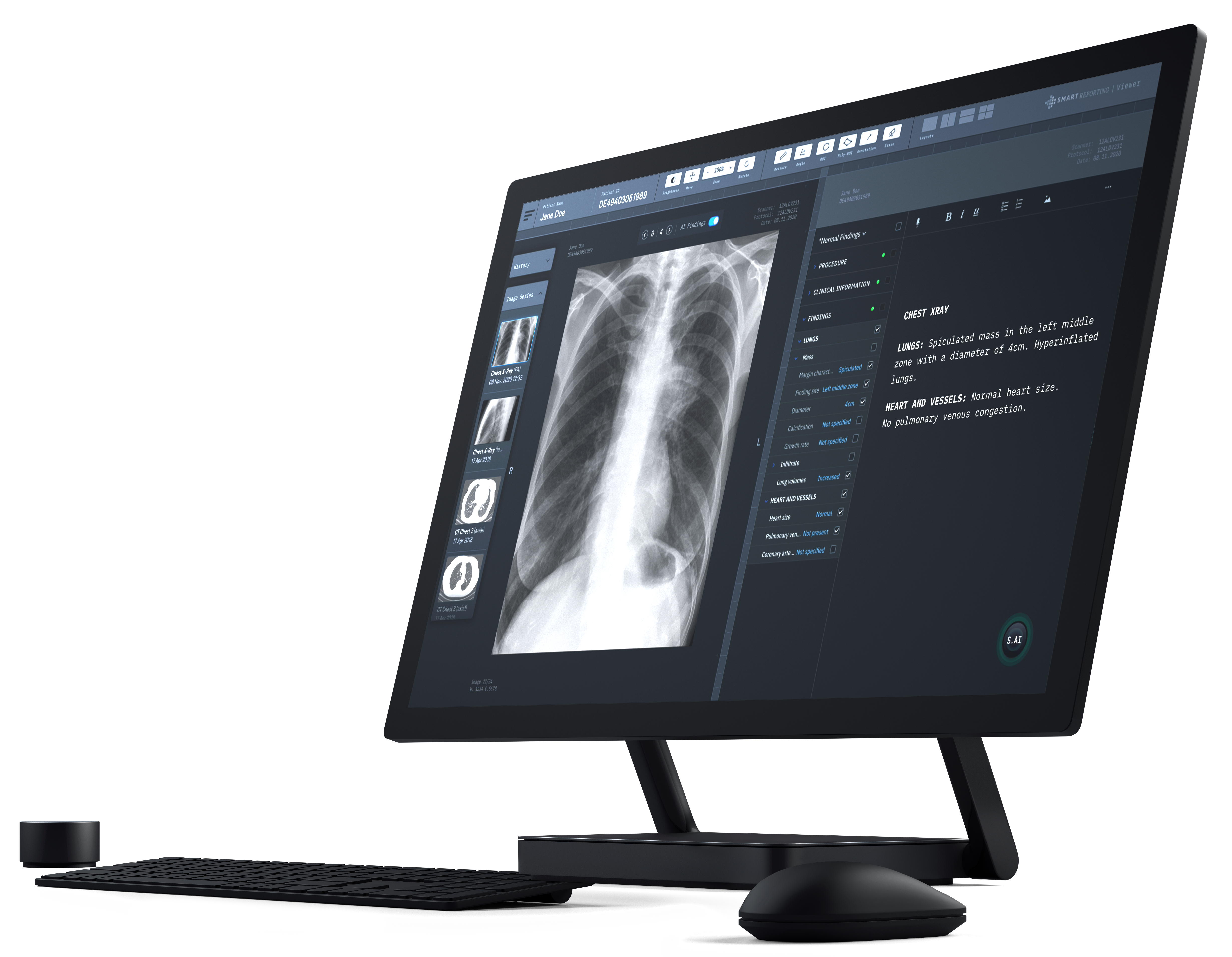 Bildschirm mit Thorax Roentgenbild und strukturiertem Befund Bildschirm mit Thorax Roentgenbild und strukturiertem Befund